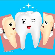 teeth whitening 1